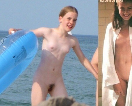 Bare Lake Days photos - Mutual respect as an important part of the naturist community